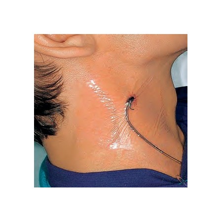 Hydrofilm plus medicazione adesiva trasparente in poliuretano 5 x 7,2 cm 5 pz.