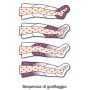 Pressoterapia pressomassaggio mesis plus+ dotazione basic (2 gambali)