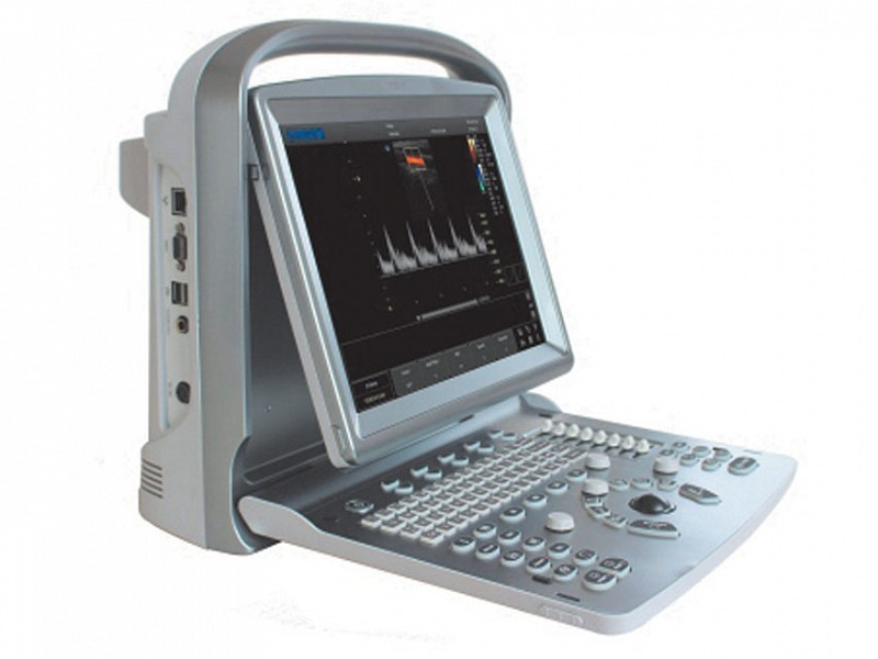 Eco-Color Doppler
