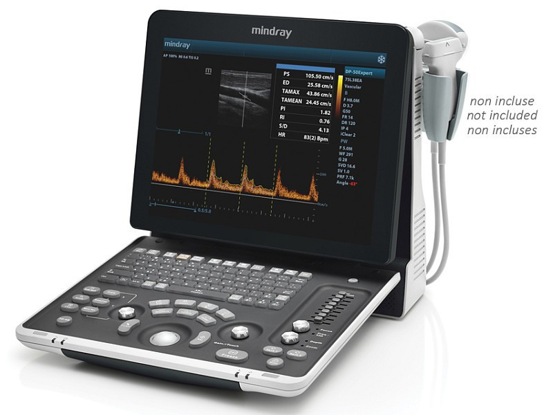Ecografi - Ecodoppler